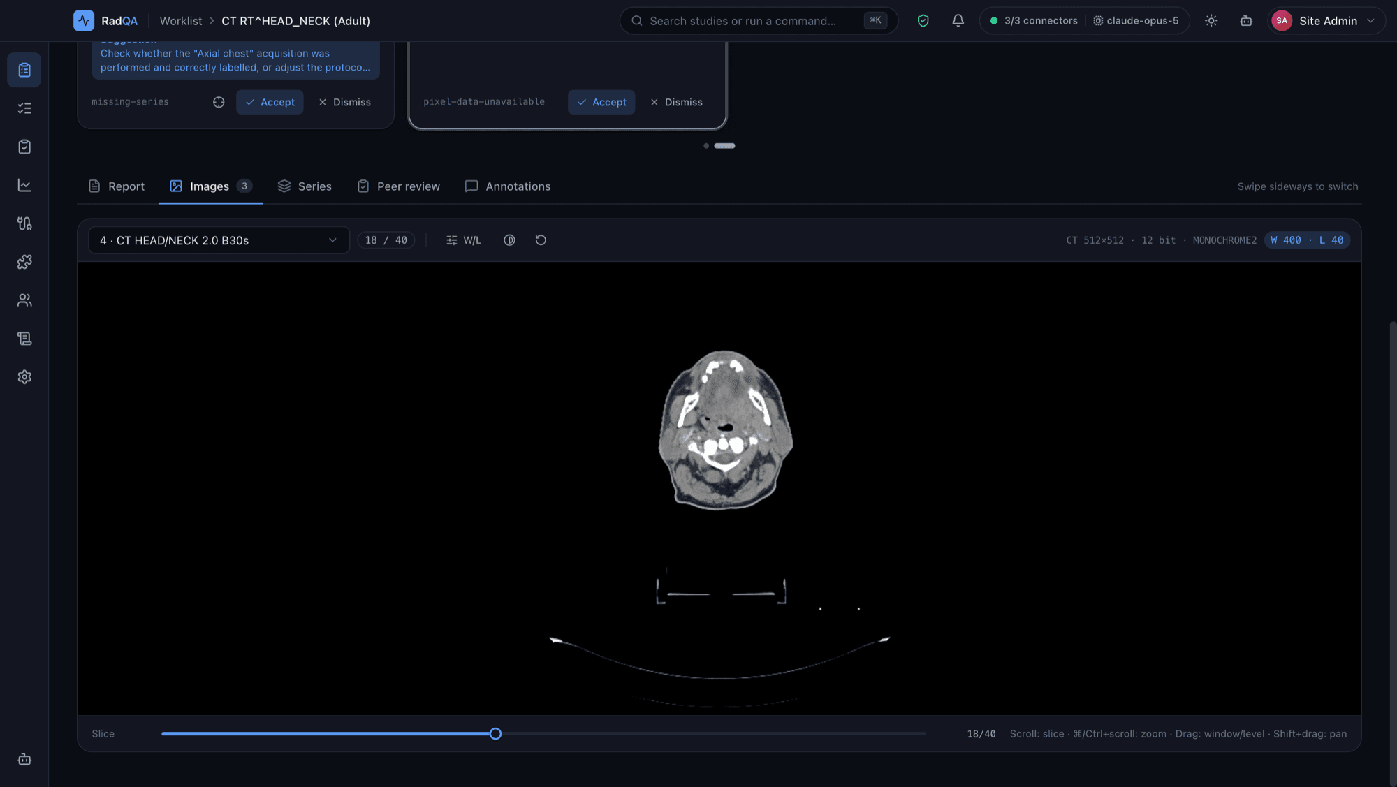 RadQA image viewer in dark mode showing slice 18 of a real head and neck CT
